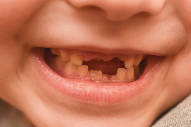 istock Happy boy smiling and showing his milk-tooth that has fallen out. 1158558458