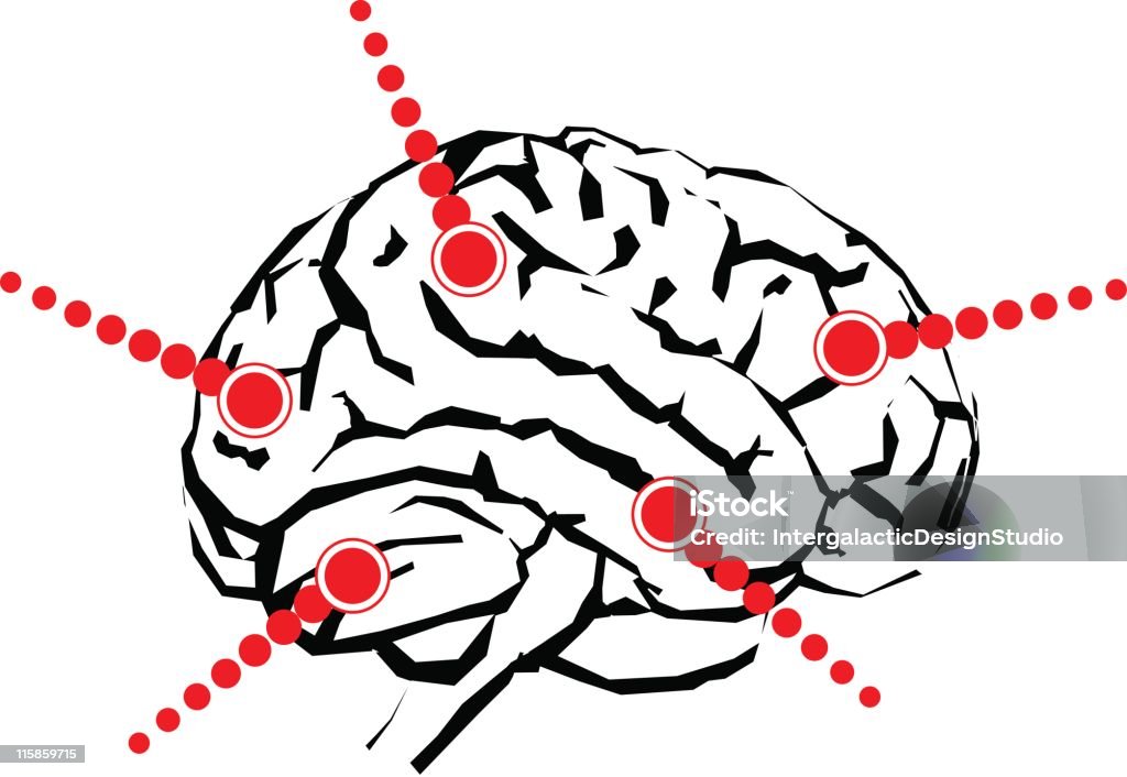 Mózgu z obiektami callout - Grafika wektorowa royalty-free (Ból)