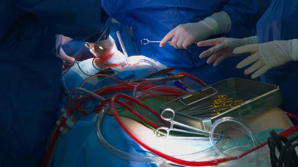 Surgical operation Surgical operation surgical light stock pictures, royalty-free photos & images