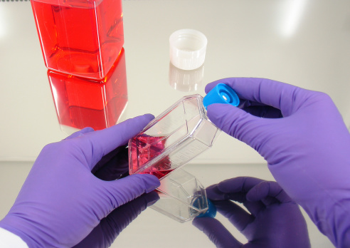 Hands of a scientist wearing protective gloves open/close a cell culture flask.