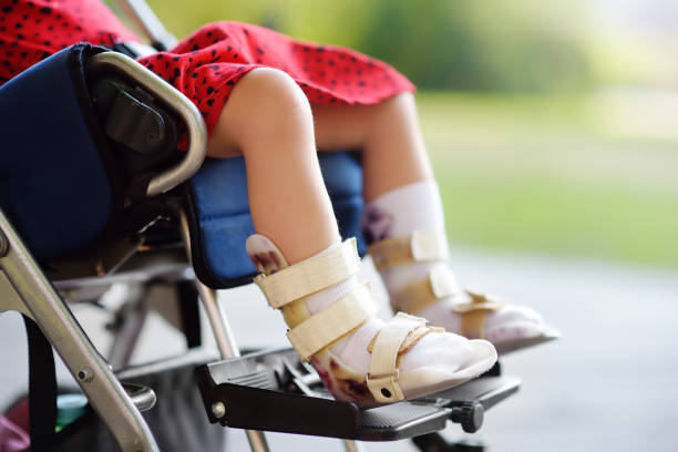 Disabled girl sitting in wheelchair. On her legs orthopedic equipment . Child cerebral palsy. Inclusion. stock photo