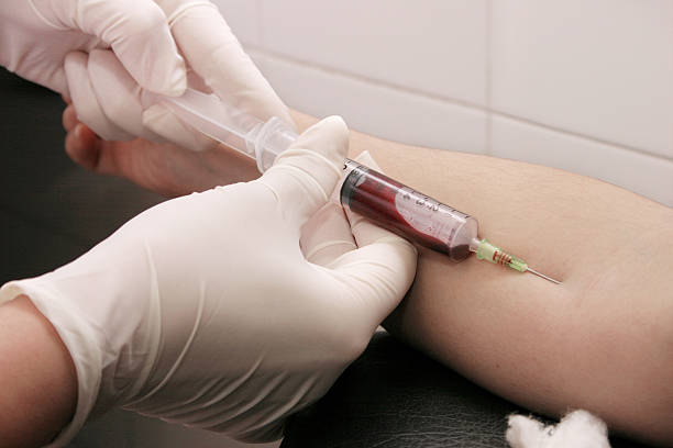 extraction de sang avec seringue à hospital - test du sida photos et images de collection