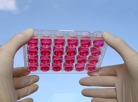 Hands in protective gloves hold cell culture plate against the sky.