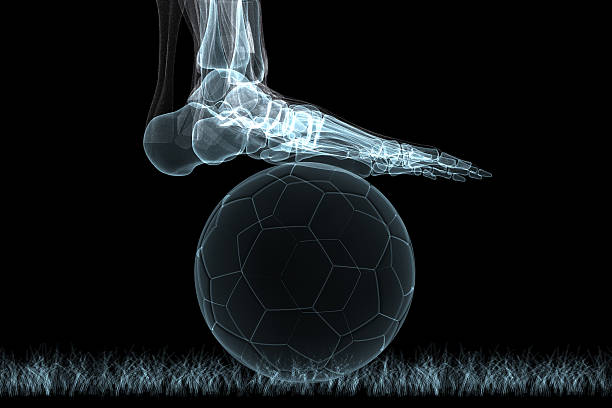 xray - soccer x ray physical injury human foot stock-fotos und bilder