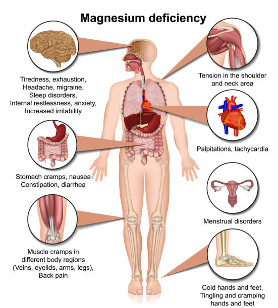 illustrations, cliparts, dessins animés et icônes de insuffisance de magnésium 3d illustration médicale de vecteur d'isolement sur l'infographie blanche de fond - secondary action