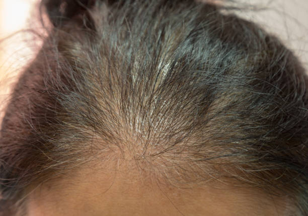 istock gray hair 1159047707