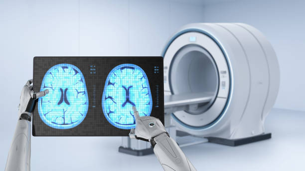 medical technology concept - brain mri scan alzheimers disease medical scan imagens e fotografias de stock