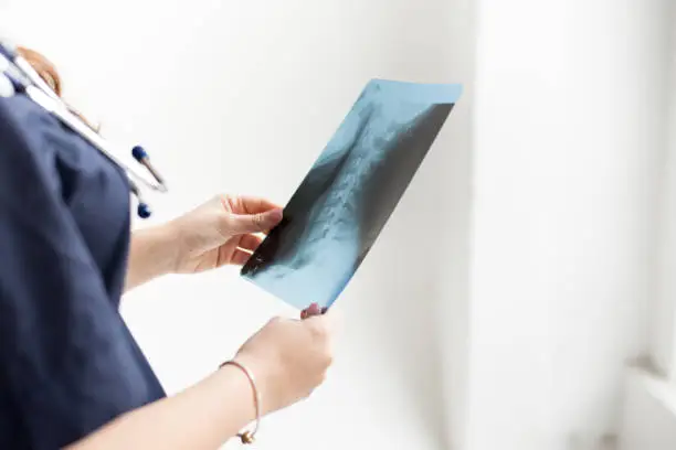 Photo of Doctor examining chest x-ray film of patient at hospital on white background, copy space