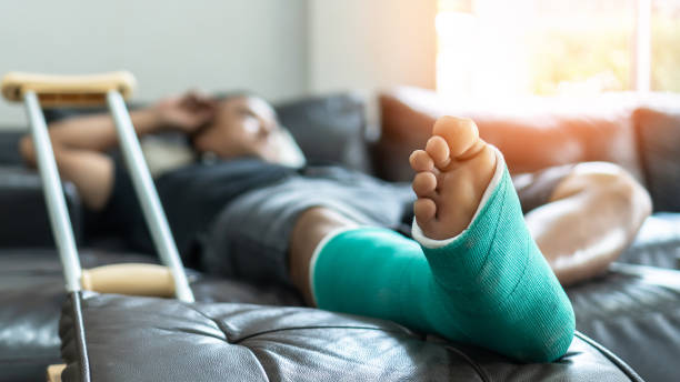 pied et jambe de fracture d'os sur le patient masculin présentant la fonte et les béquilles d'attelle pendant la réadaptation de chirurgie et le rétablissement orthopédique restant à la maison - crutch photos et images de collection