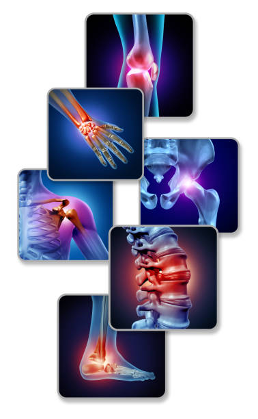 Human Joint Pain Human joint pain concept as skeleton and muscle anatomy of the body with a group of sore joints as a painful injury or arthritis illness symbol for health care and medical symptoms with 3D illustration elements. femur photos stock pictures, royalty-free photos & images