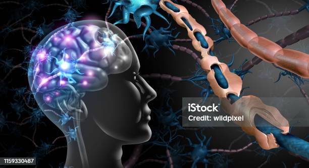 Multiple Sclerosis Nerve Disorder Stock Photo - Download Image Now - Multiple Sclerosis, Brain, Nerve Cell