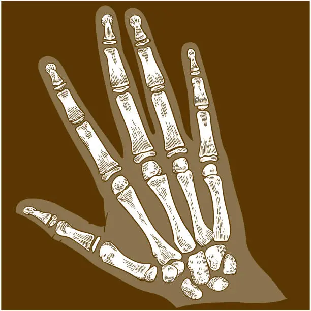 Vector illustration of engraving illustration of hand bone x-ray