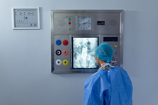 Rear view of diverse female surgeon examining x ray on x-ray light box at hospital