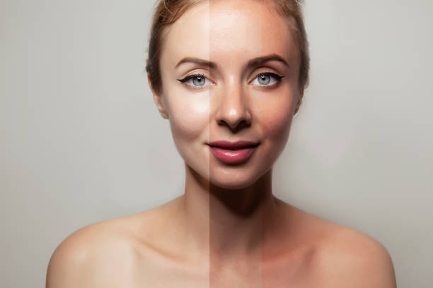 istock stages of tanning on woman`s face 1159461710
