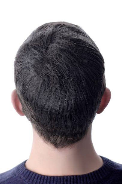 istock Men hair after using cosmetic powder for hair thickening. White isolate. 1159524585