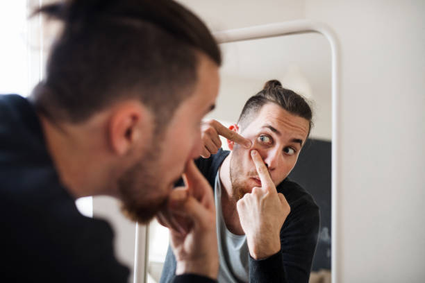 istock A young man indoors looking in the mirror, squeezing a pimple. 1159565851