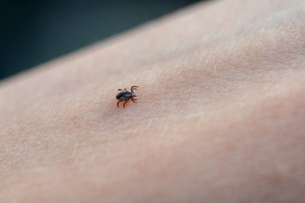 istock Tick on human skin 1159575803