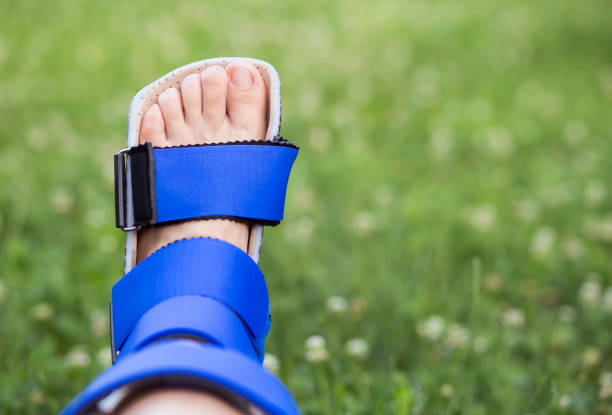 Recovery of ankle with support brace Foot ankle recovery, stabilizing with support brace blue and green braces stock pictures, royalty-free photos & images