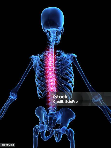 3 D 허리통증 3차원 형태에 대한 스톡 사진 및 기타 이미지 - 3차원 형태, 건강관리와 의술, 경련