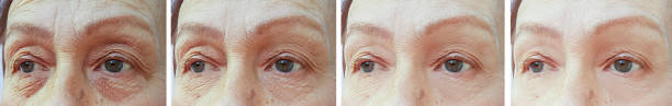 istock old woman wrinkles before and after correction 1159607454