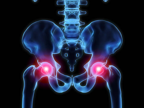 x-ray hip - pain stock photo
