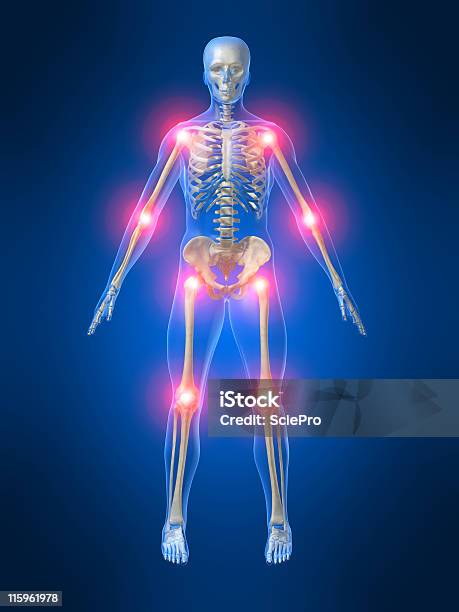 Dolor En Las Articulaciones Foto de stock y más banco de imágenes de Inflamación - Inflamación, Articulación, Gráfico por ordenador