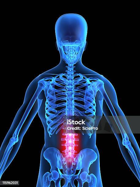 Foto de A Dor Lombar e mais fotos de stock de Anatomia - Anatomia, Artrite, Biologia