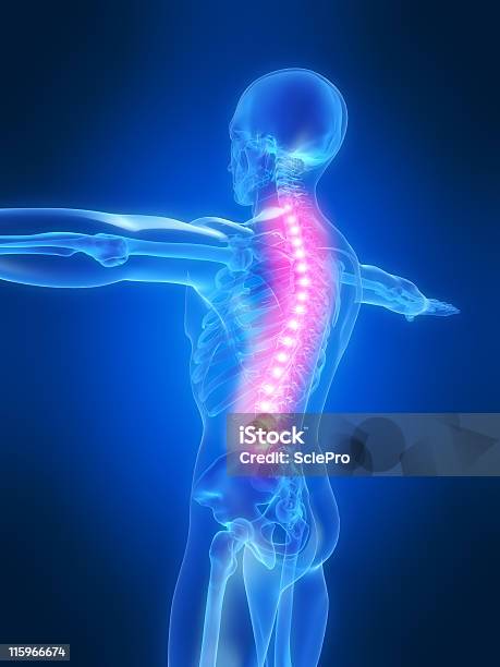 Backache Illustration Stock Photo - Download Image Now - Anatomy, Arthritis, Backache