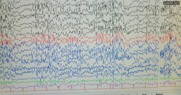istock A computer monitor showing electrical activity of the brain, electroencephalogram,EEG 1159806948