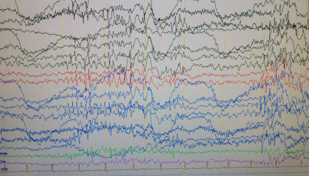 istock A computer monitor showing electrical activity of the brain, electroencephalogram,EEG 1159807054