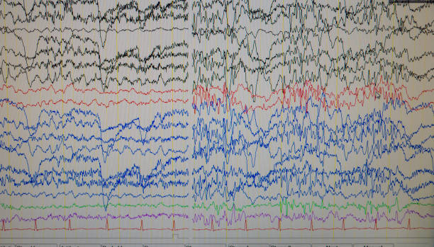 istock A computer monitor showing electrical activity of the brain, electroencephalogram,EEG 1159807067