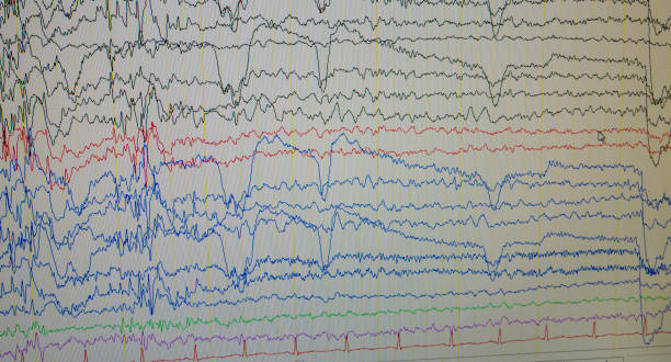 istock A computer monitor showing electrical activity of the brain, electroencephalogram,EEG 1159807117
