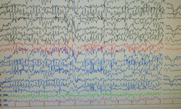 istock A computer monitor showing electrical activity of the brain, electroencephalogram,EEG 1159807207