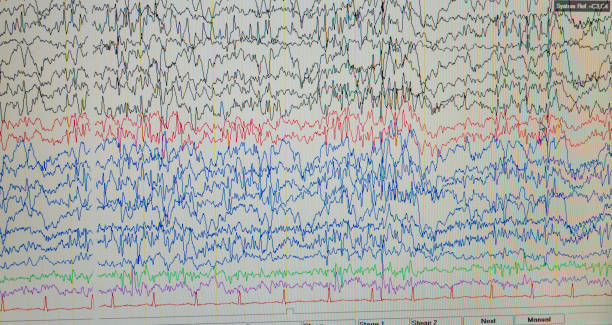 istock A computer monitor showing electrical activity of the brain, electroencephalogram,EEG 1159807247