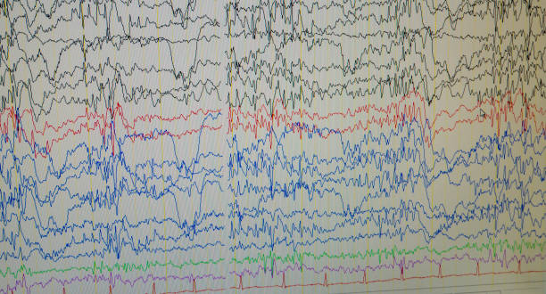 istock A computer monitor showing electrical activity of the brain, electroencephalogram,EEG 1159807313