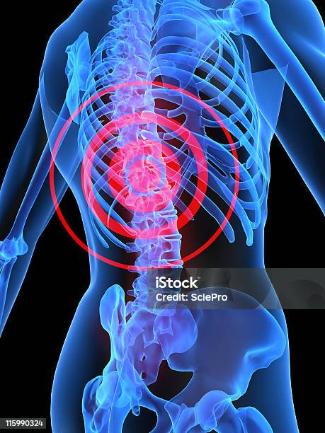 Rückenschmerzen Stockfoto und mehr Bilder von Brustkorb - Menschlicher Knochen - Brustkorb - Menschlicher Knochen, Schmerz, Anatomie