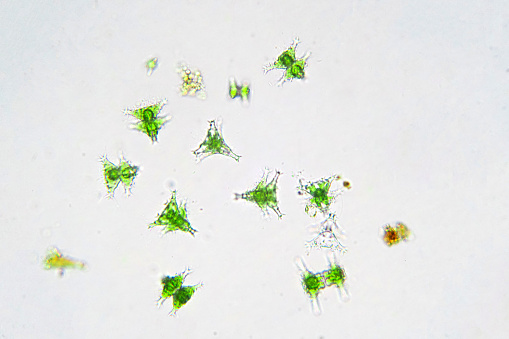 Freshwater aquatic plankton under microscope view in laboratory.