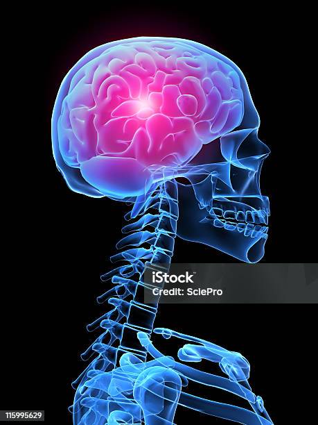 Ból Głowy Ilustracja - zdjęcia stockowe i więcej obrazów Natchnienie - Natchnienie, Ból głowy, Trójwymiarowy