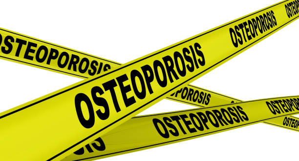 istock Osteoporosis. Yellow warning tapes 1160010585