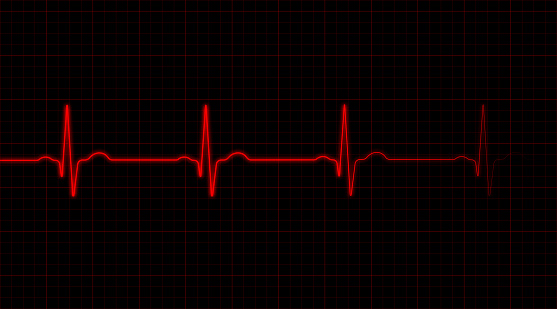 EKG rojo sobre fondo negro photo