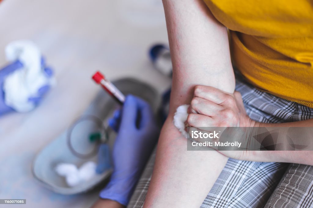 Close-cup shot of nurse and patient in hospital Nurse with blood test and patient in hospital – Female doctor holding small plastic vial and person’s arm with wadding – Young adult in a medical clinic for analyses Blood Stock Photo