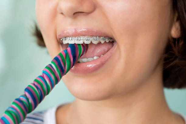 istock Woman with dental braces biting lollipop 1160083942