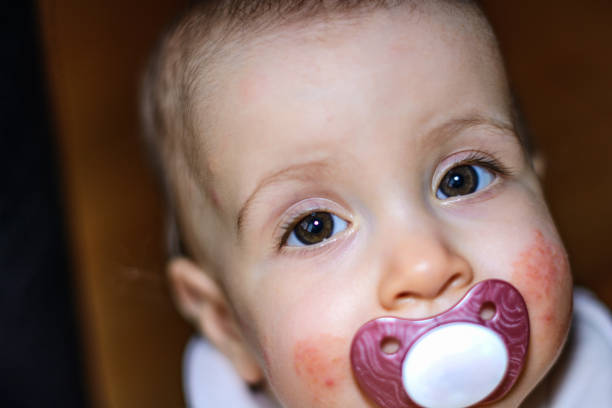 Close photo portrait of a little toddler stand in hospital bed with frame, catheter in his hand holding pacifier