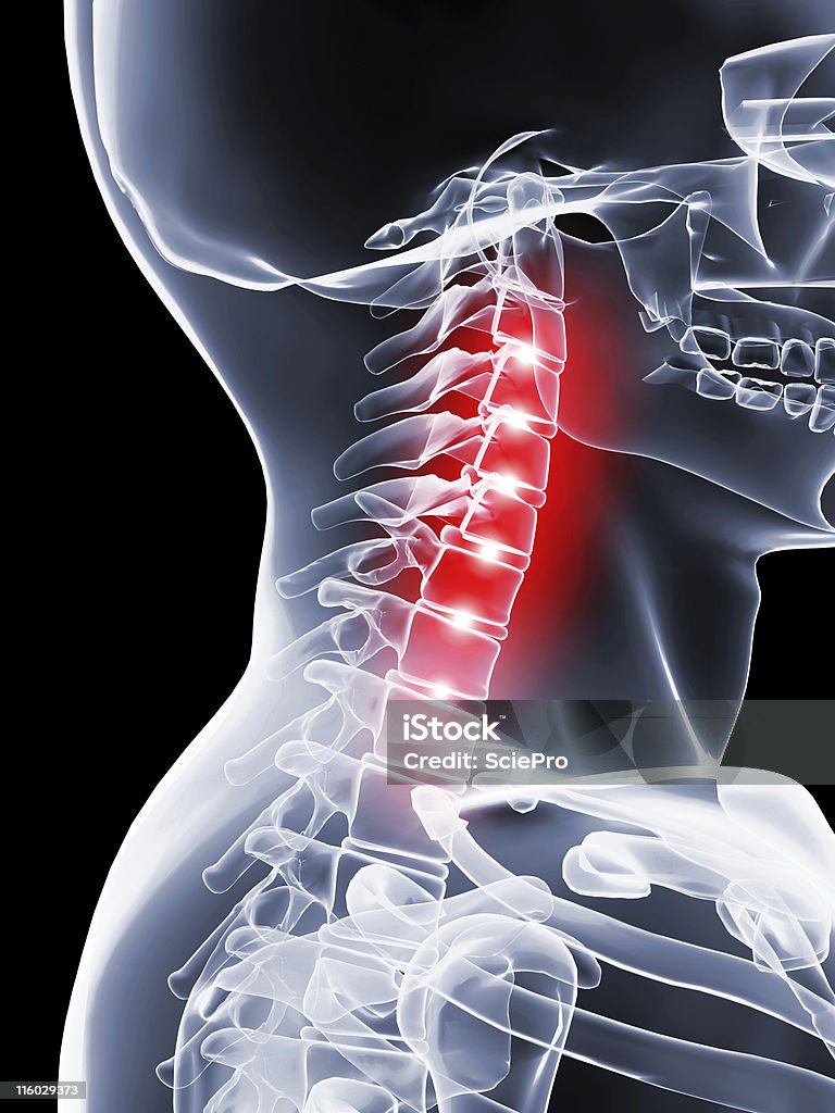 Cou de la douleur - Photo de Anatomie libre de droits