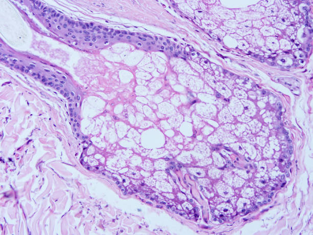istock histology of human tissue 1160328988