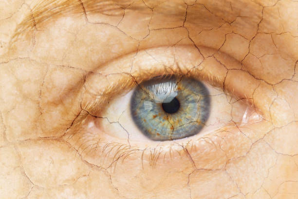 ひび割れた皮膚。ひび割れた皮膚を持つ女性の目のクローズアップ。老化プロセスや痛みや孤独の概念的イメージ。 - human skin dry human face peeling ストックフォトと画像