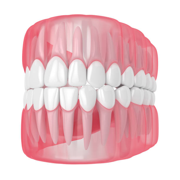 istock 3d render of jaw with teeth over white 1160424796
