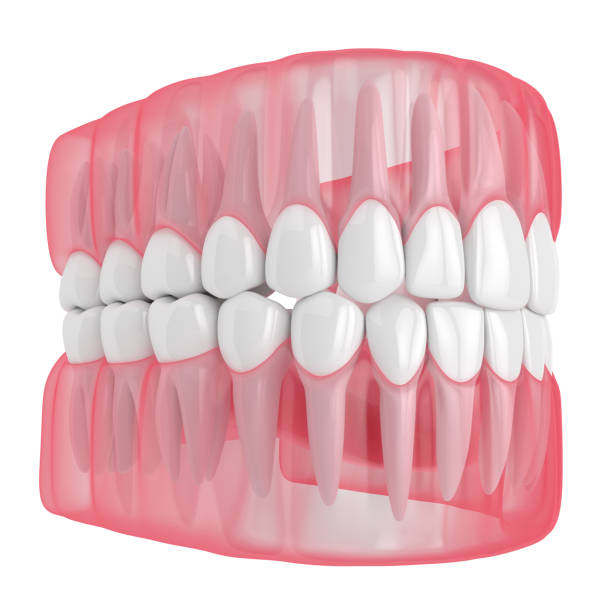 istock 3d render of jaw with teeth over white 1160424804