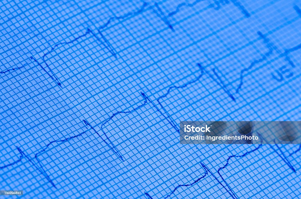 Electrocardiogram (ECG - Lizenzfrei Biegung Stock-Foto