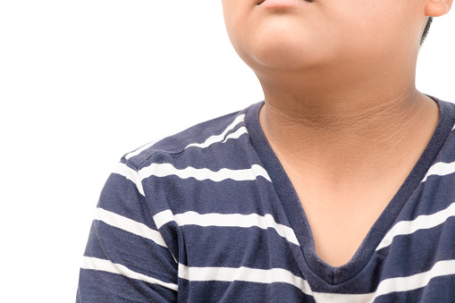 Black marks of the skin around the neck  of overweight children isolated on white background, One of the warning signs of diabetes.